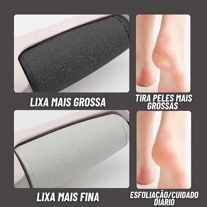 Lixa Elétrica Removedor de Calos e Rachaduras para os Pés